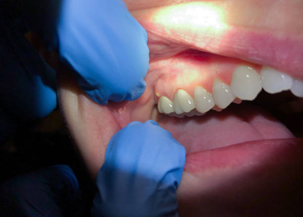 Best Emergency TMJ Treatment in La Palma, CA